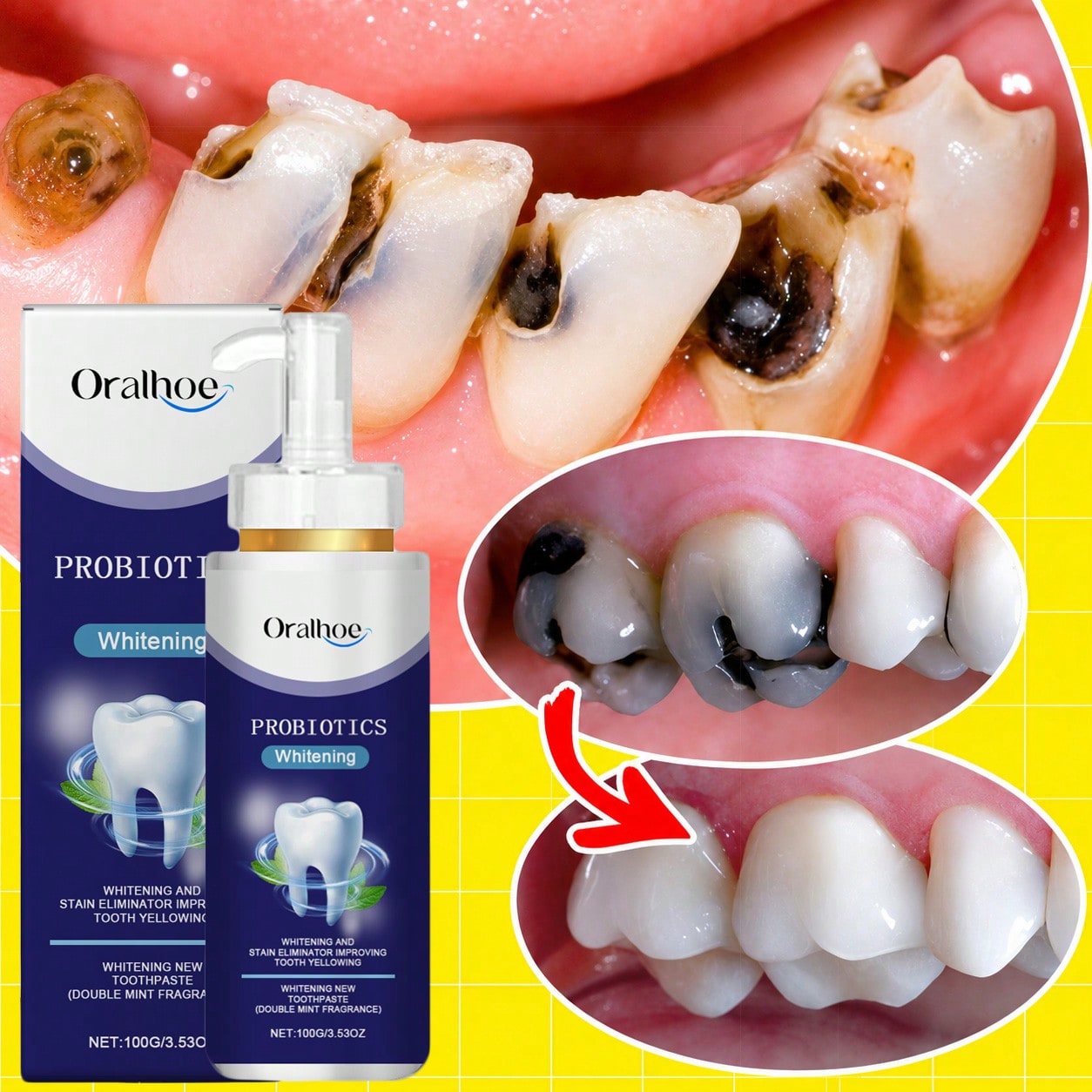 oralhoe Whitening Toothpaste 100g, Probiotic Mint Toothpaste For Surface Stains Yellowing Fresh Breath, Gentle Tooth Cleaning Paste With Hydroxyapatite, Daily Oral Care Pump Bottle