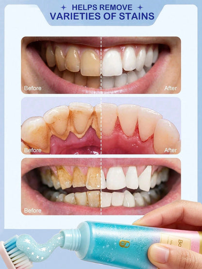 Niacinamide Whitening Toothpaste, Clean Peach Flavor, Get Rid Of Smoke Stains, Coffee Stains, Tea Stains, Keep Your Mouth Clean And White, Good Choice For Vacation, Beach, Travel Essentials, Suitable