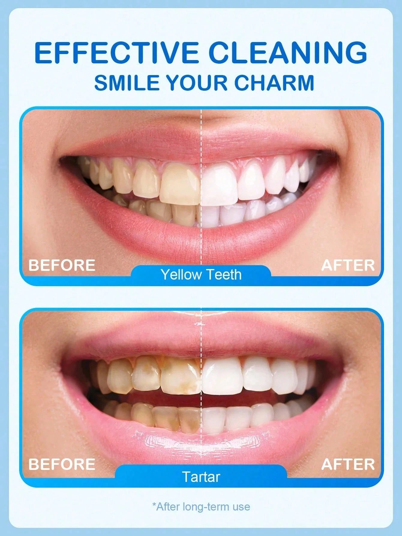 Niacinamide Whitening Toothpaste, Clean Peach Flavor, Get Rid Of Smoke Stains, Coffee Stains, Tea Stains, Keep Your Mouth Clean And White, Good Choice For Vacation, Beach, Travel Essentials, Suitable