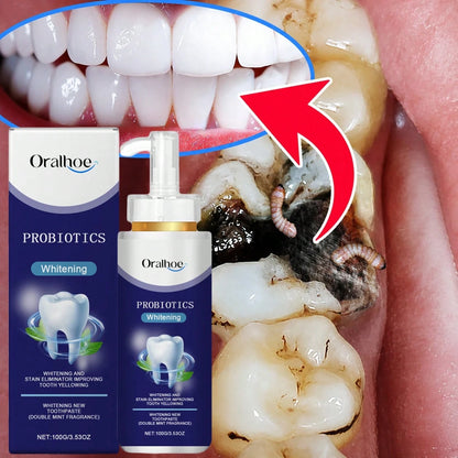 oralhoe Whitening Toothpaste 100g, Probiotic Mint Toothpaste For Surface Stains Yellowing Fresh Breath, Gentle Tooth Cleaning Paste With Hydroxyapatite, Daily Oral Care Pump Bottle