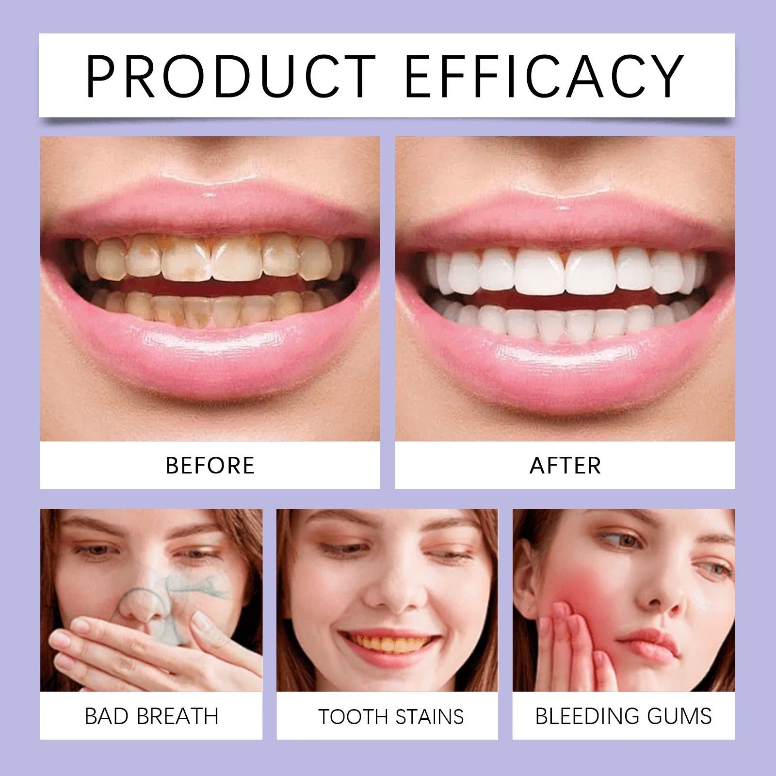 oralhoe Whitening Toothpaste 100g, Probiotic Mint Toothpaste For Surface Stains Yellowing Fresh Breath, Gentle Tooth Cleaning Paste With Hydroxyapatite, Daily Oral Care Pump Bottle